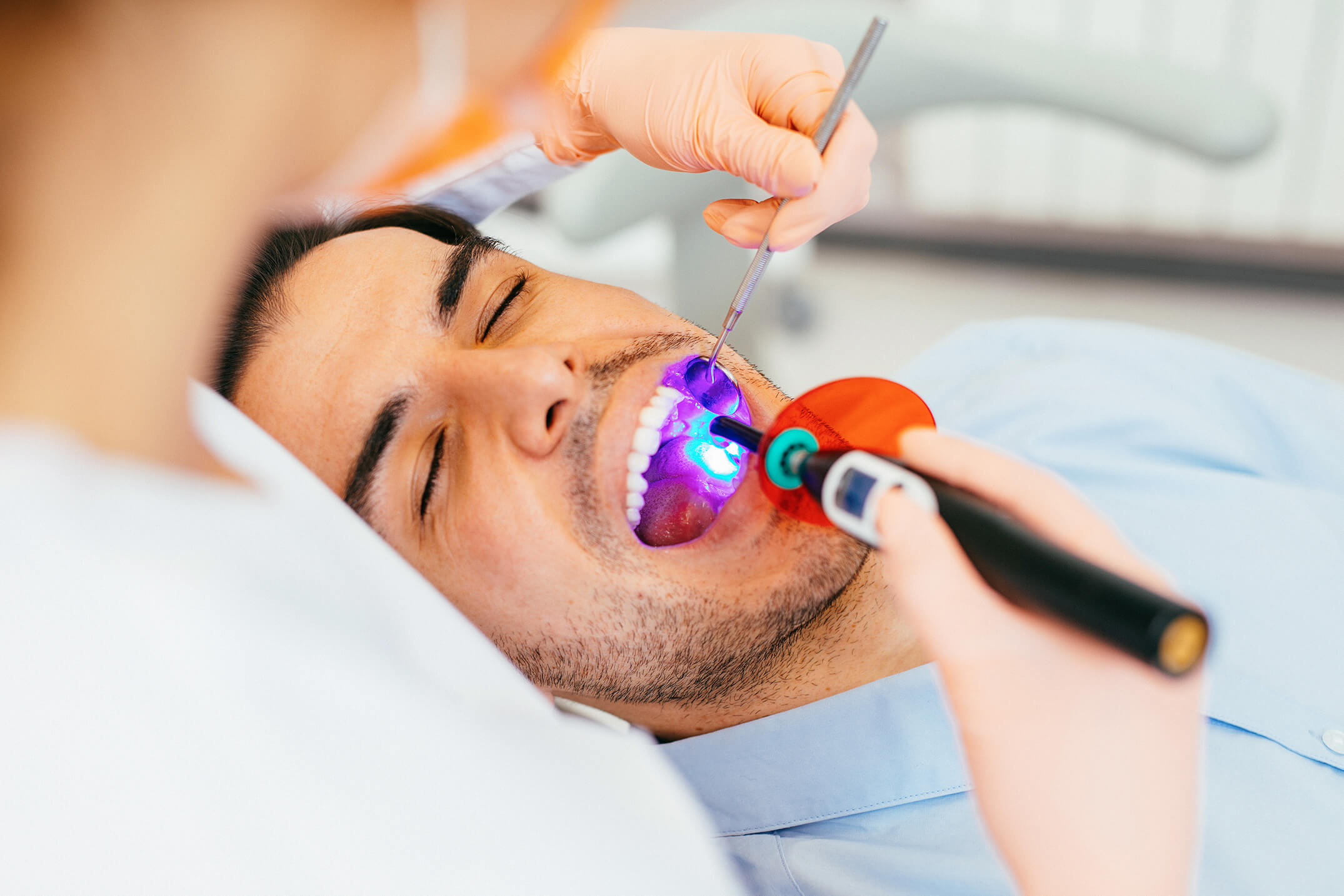 Sealants
